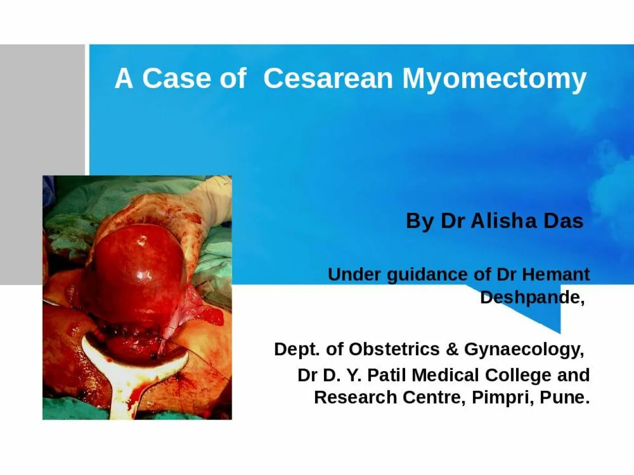 PPT-A Case of Cesarean Myomectomy