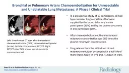 Bronchial or Pulmonary Artery Chemoembolization for Unresectable and