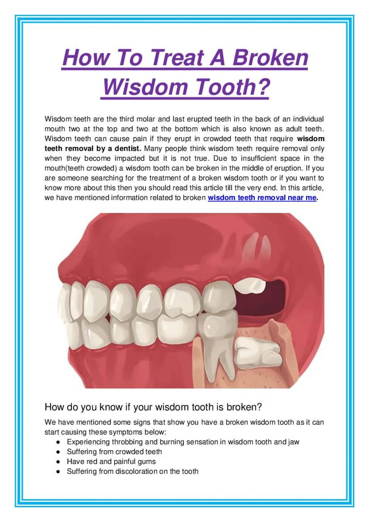 PDF-How To Treat A Broken Wisdom Tooth?