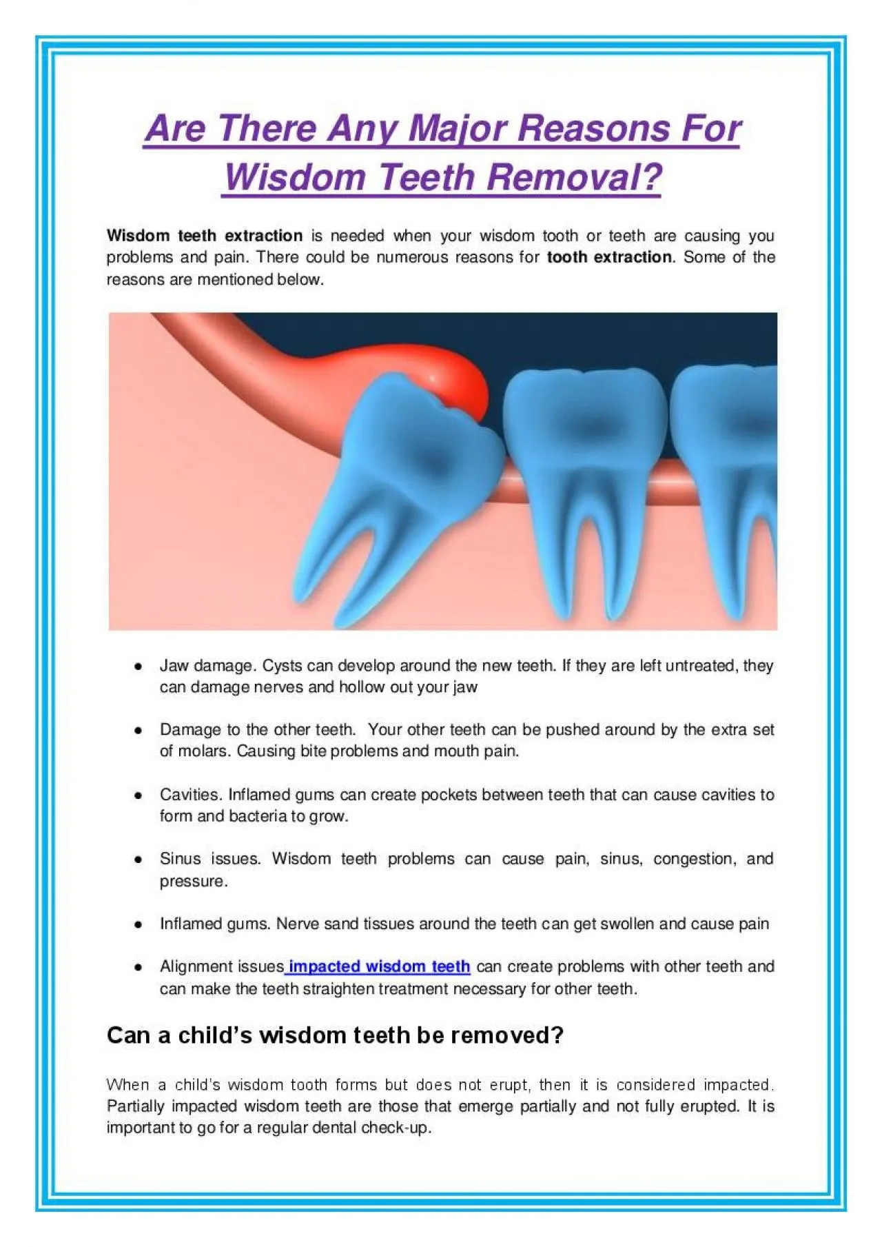 PDF-Are There Any Major Reasons For Wisdom Teeth Removal?