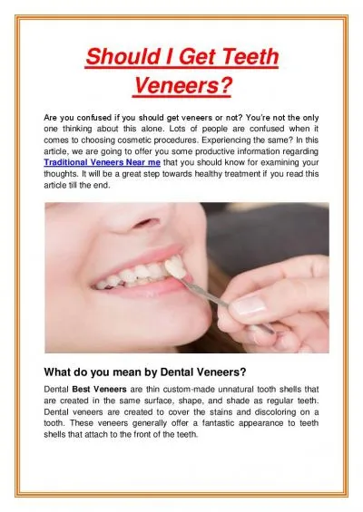 Should I Get Teeth Veneers?