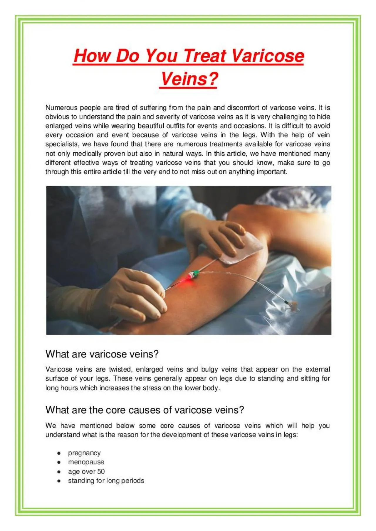 PDF-How Do You Treat Varicose Veins?