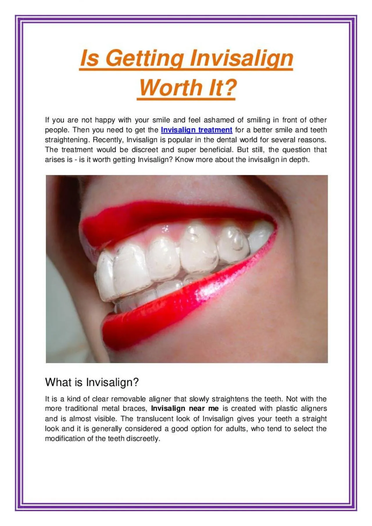 PDF-Is Getting Invisalign Worth It?