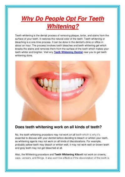 Why Do People Opt For Teeth Whitening?