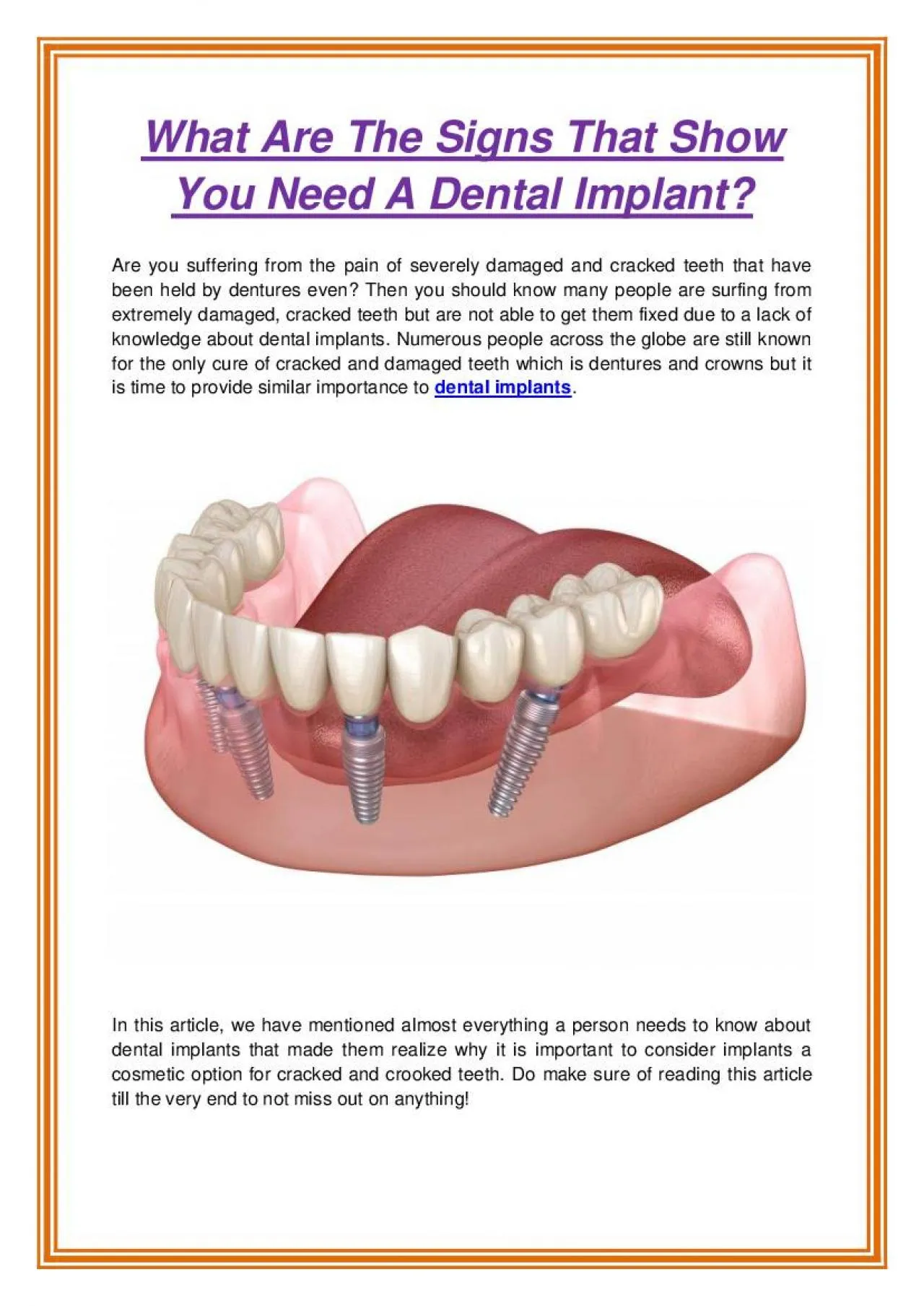 PDF-What Are The Signs That Show You Need A Dental Implant?