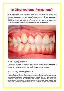 Is Gingivectomy Permanent?