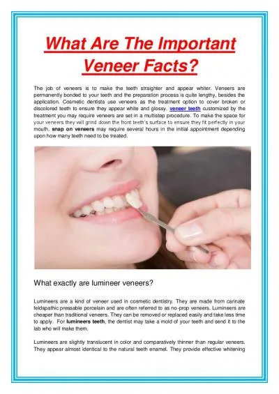 What Are The Important Veneer Facts?