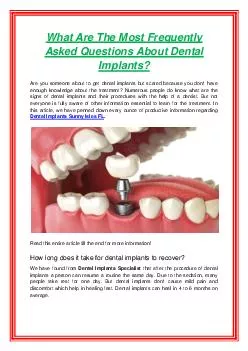 What Are The Most Frequently Asked Questions About Dental Implants?