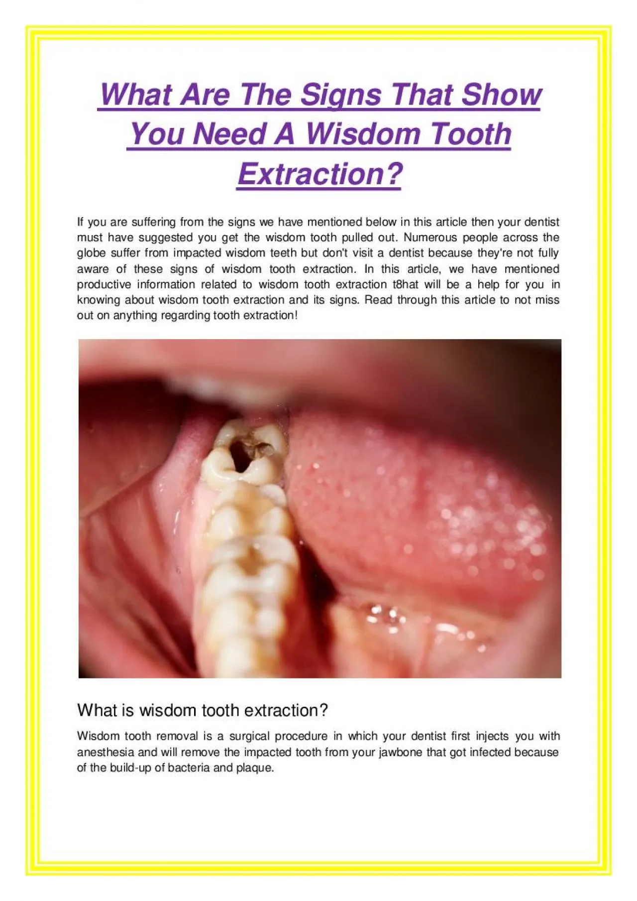 PDF-What Are The Signs That Show You Need A Wisdom Tooth Extraction?