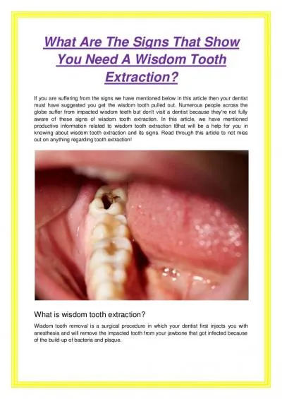 What Are The Signs That Show You Need A Wisdom Tooth Extraction?