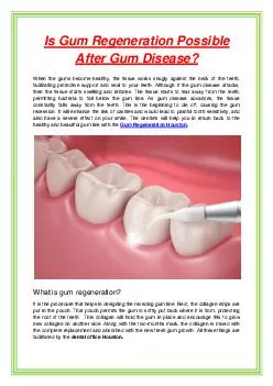 Is Gum Regeneration Possible After Gum Disease?