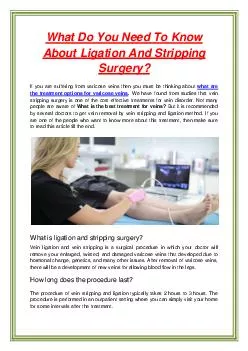 What Do You Need To Know About Ligation And Stripping Surgery?