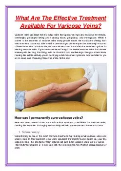 What Are The Effective Treatment Available For Varicose Veins?