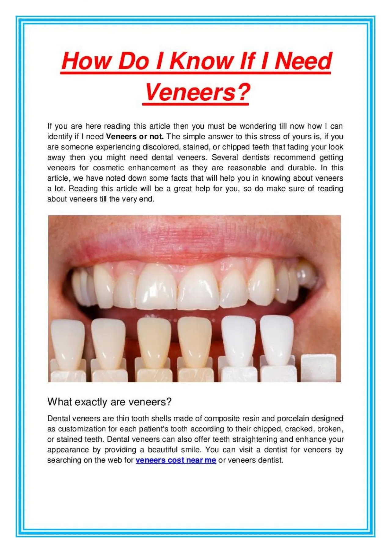 PDF-How Do I Know If I Need Veneers?