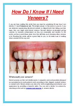 How Do I Know If I Need Veneers?