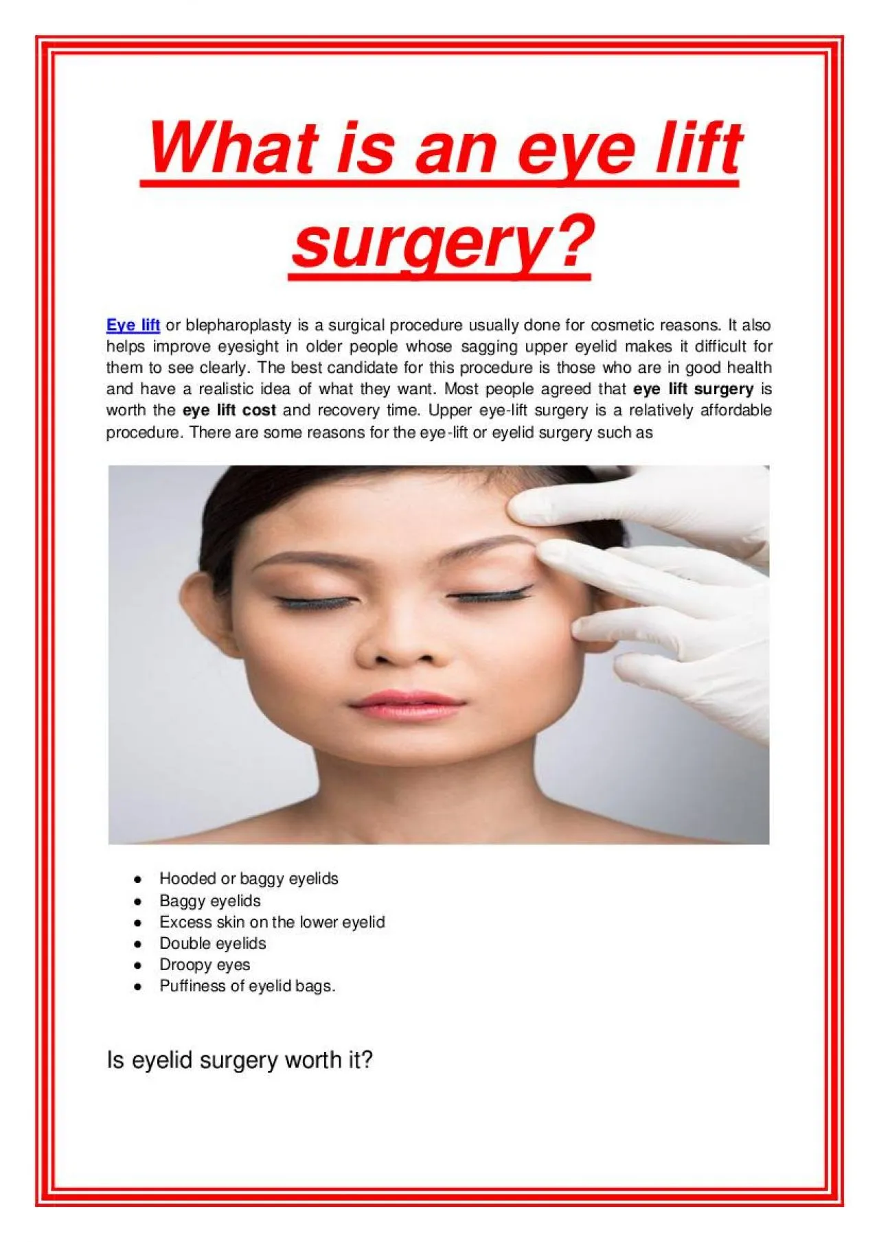 PDF-What is an eye lift surgery?