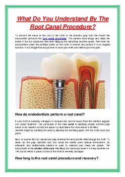What Do You Understand By The Root Canal Procedure?
