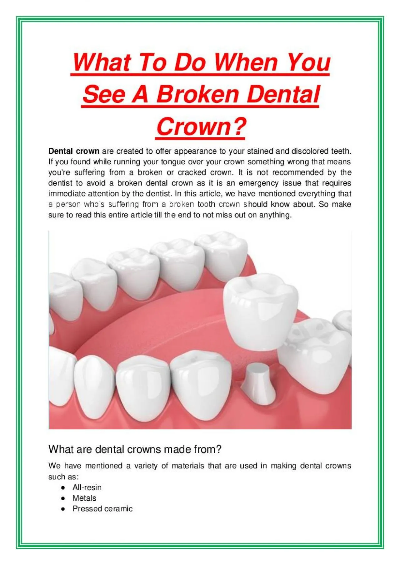 PDF-What To Do When You See A Broken Dental Crown?