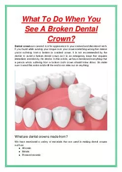 What To Do When You See A Broken Dental Crown?