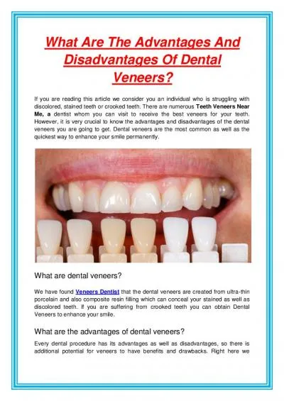 What Are The Advantages And Disadvantages Of Dental Veneers?