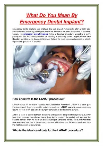 What Do You Mean By Emergency Dental Implant?