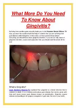What More Do You Need To Know About Gingivitis?