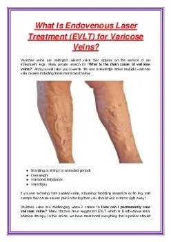 What Is Endovenous Laser Treatment (EVLT) for Varicose Veins?