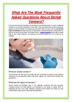 What Are The Most Frequently Asked Questions About Dental Veneers?