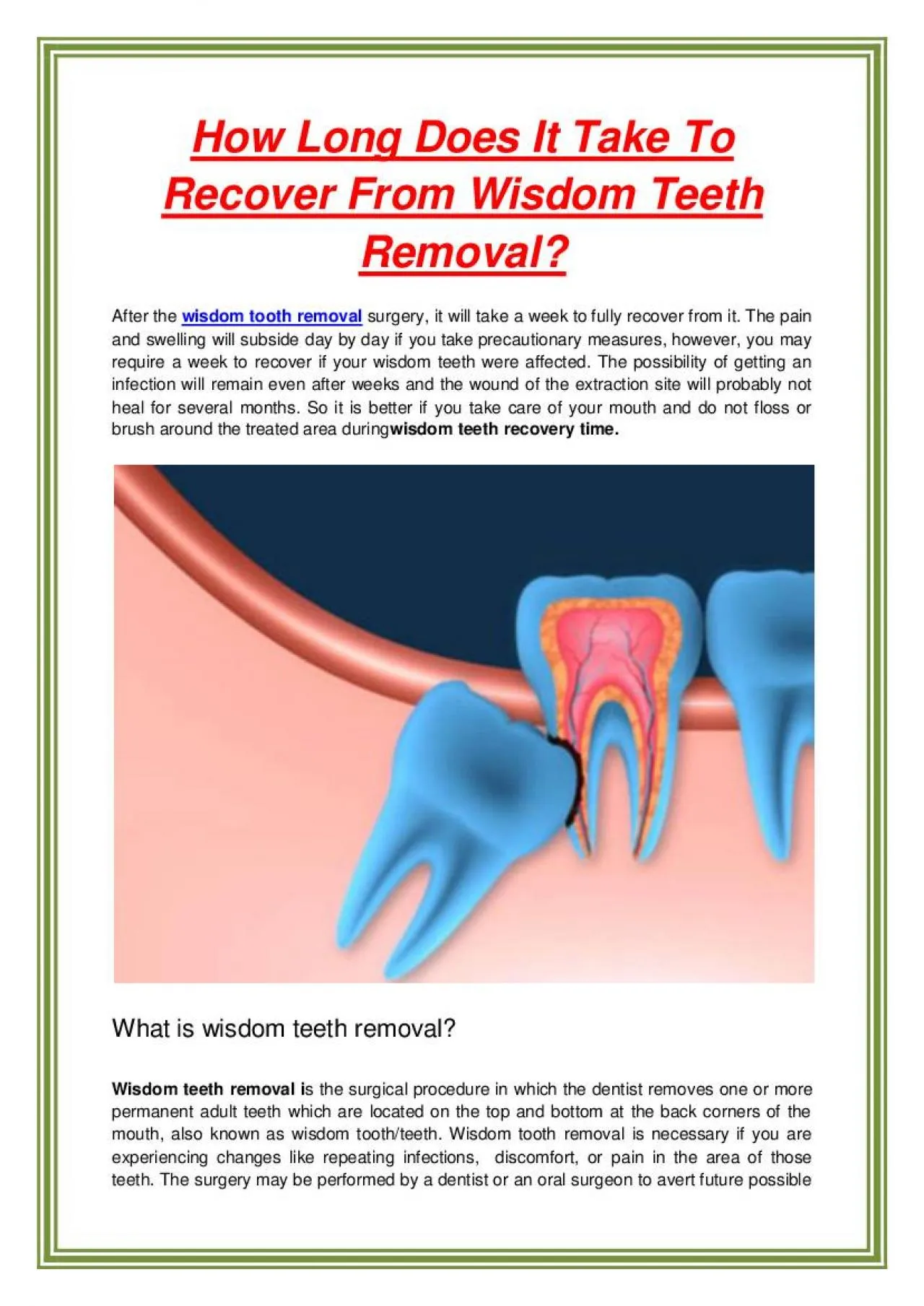 PDF-How Long Does It Take To Recover From Wisdom Teeth Removal?