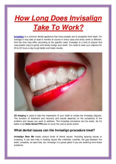 How Long Does Invisalign Take To Work?