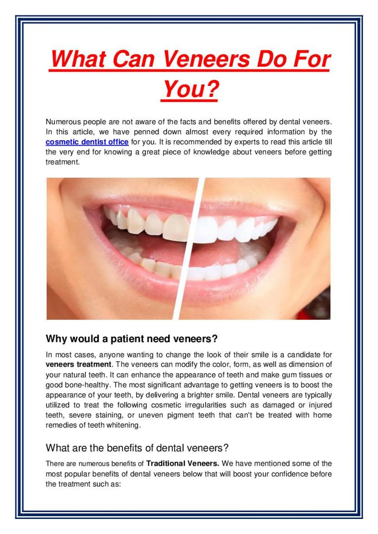 PDF-What Can Veneers Do For You?