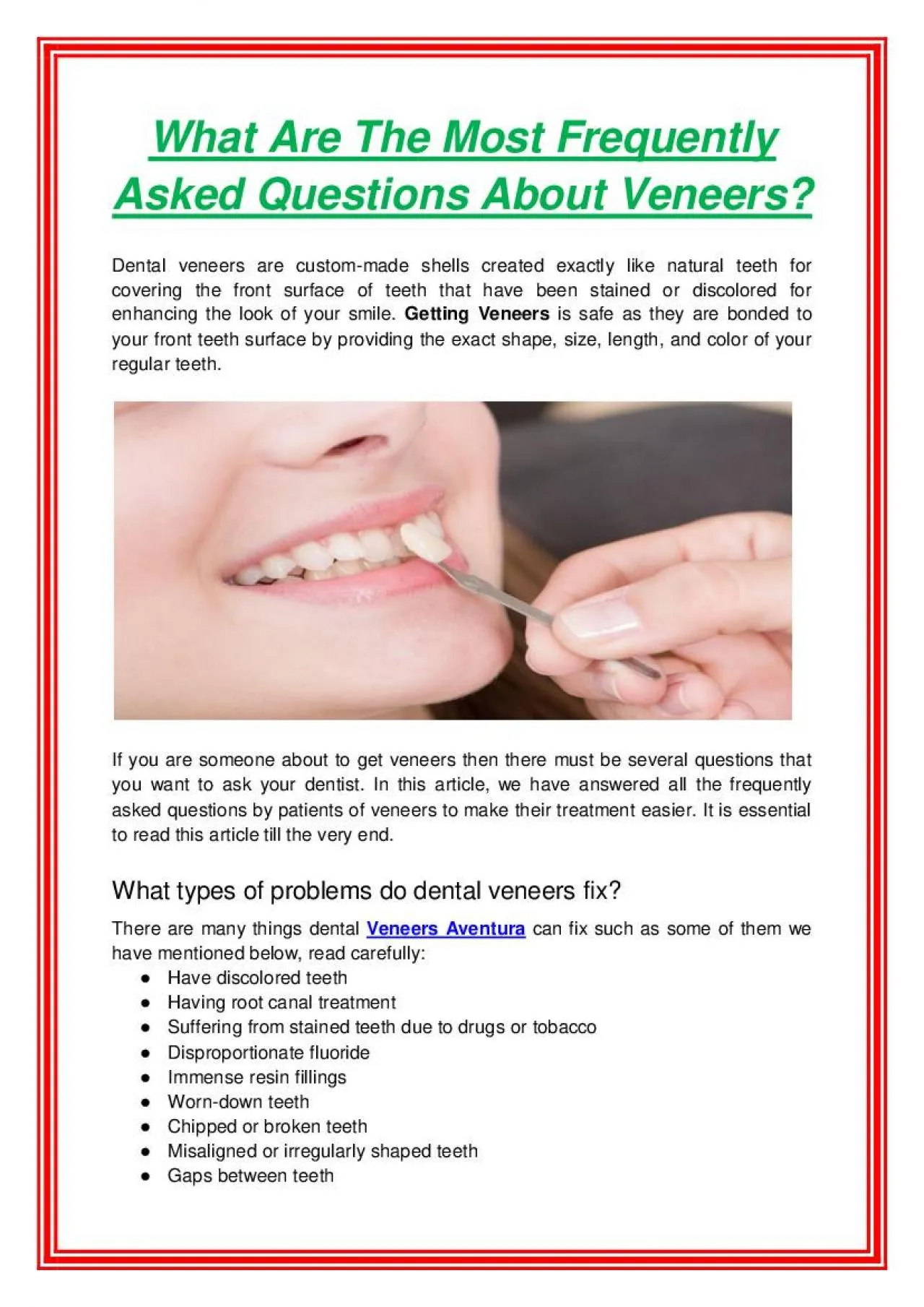 PDF-What Are The Most Frequently Asked Questions About Veneers?