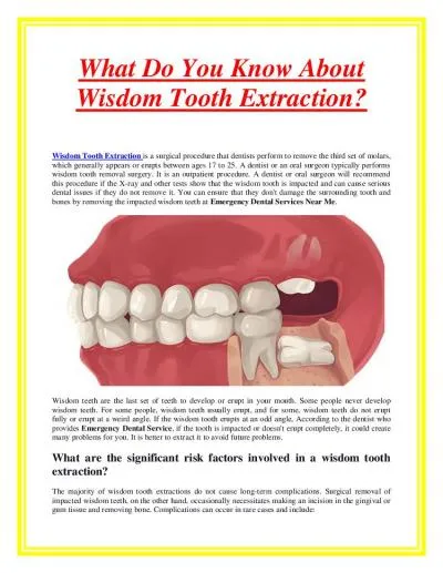 What Do You Know About Wisdom Tooth Extraction?