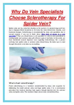 Why Do Vein Specialists Choose Sclerotherapy For Spider Vein?