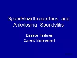 26/03/1440 Spondyloarthropathies and Ankylosing Spondylitis