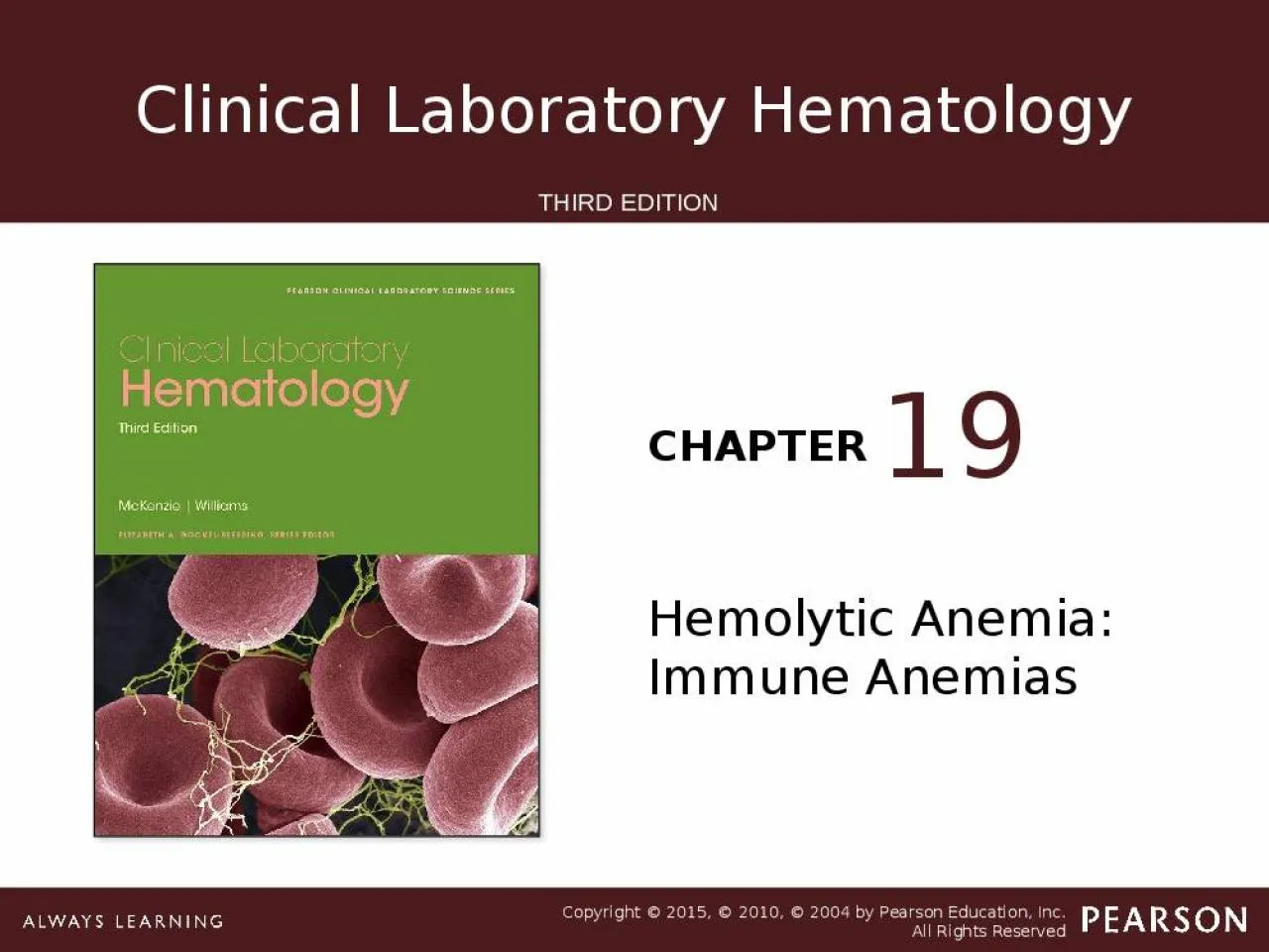 PPT-Hemolytic Anemia: Immune Anemias