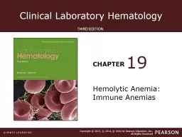 Hemolytic Anemia: Immune Anemias