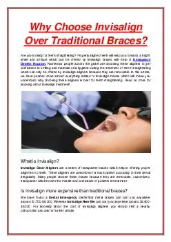 Why Choose Invisalign Over Traditional Braces?