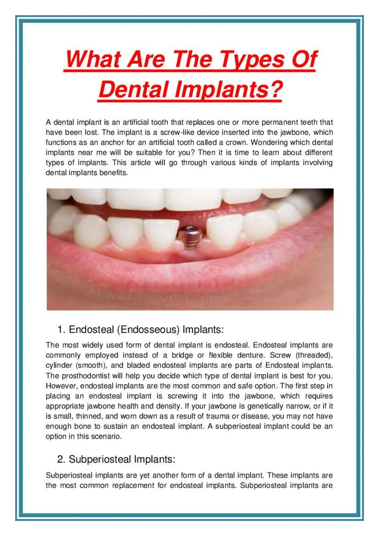 PDF-What Are The Types Of Dental Implants?