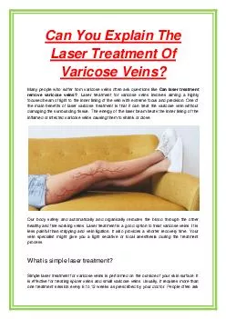 Can You Explain The Laser Treatment Of Varicose Veins?