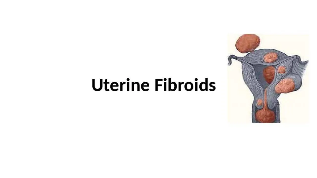 PPT-Uterine Fibroids Fibroids