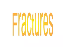 Fractures Bone Fractures