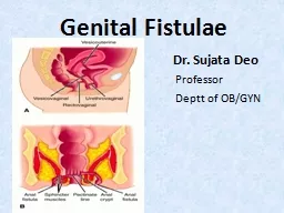 Genital Fistulae                                              Dr. Sujata Deo