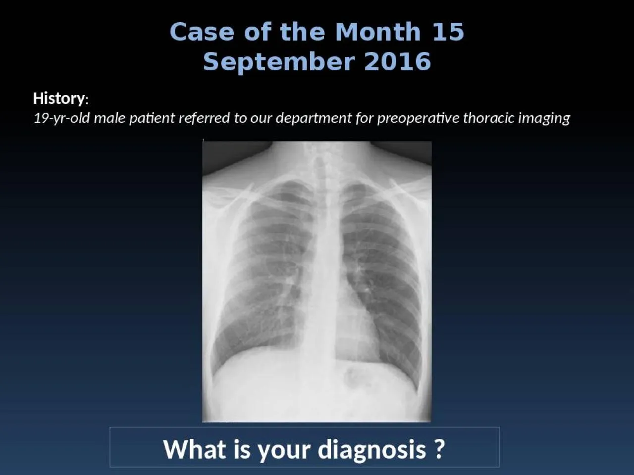 PPT-History : 19-yr-old male patient referred to our department for preoperative thoracic