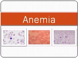 Anemia  Goals Definition of anemia