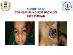 Committed To  CORNEAL  BLINDNESS BACKLOG