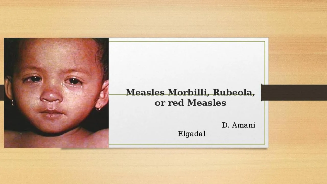 PPT-Measles M orbilli, Rubeola, or red Measles