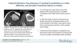 Osteoid Osteoma: Percutaneous CT-guided Cryoablation Is a Safe, Effective, and Durable