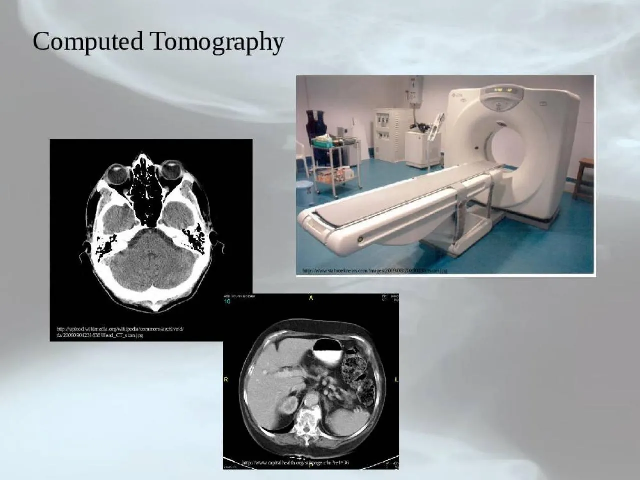 PPT-Computed Tomography http://www.stabroeknews.com/images/2009/08/20090830ctscan.jpg