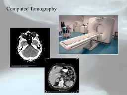 Computed Tomography http://www.stabroeknews.com/images/2009/08/20090830ctscan.jpg